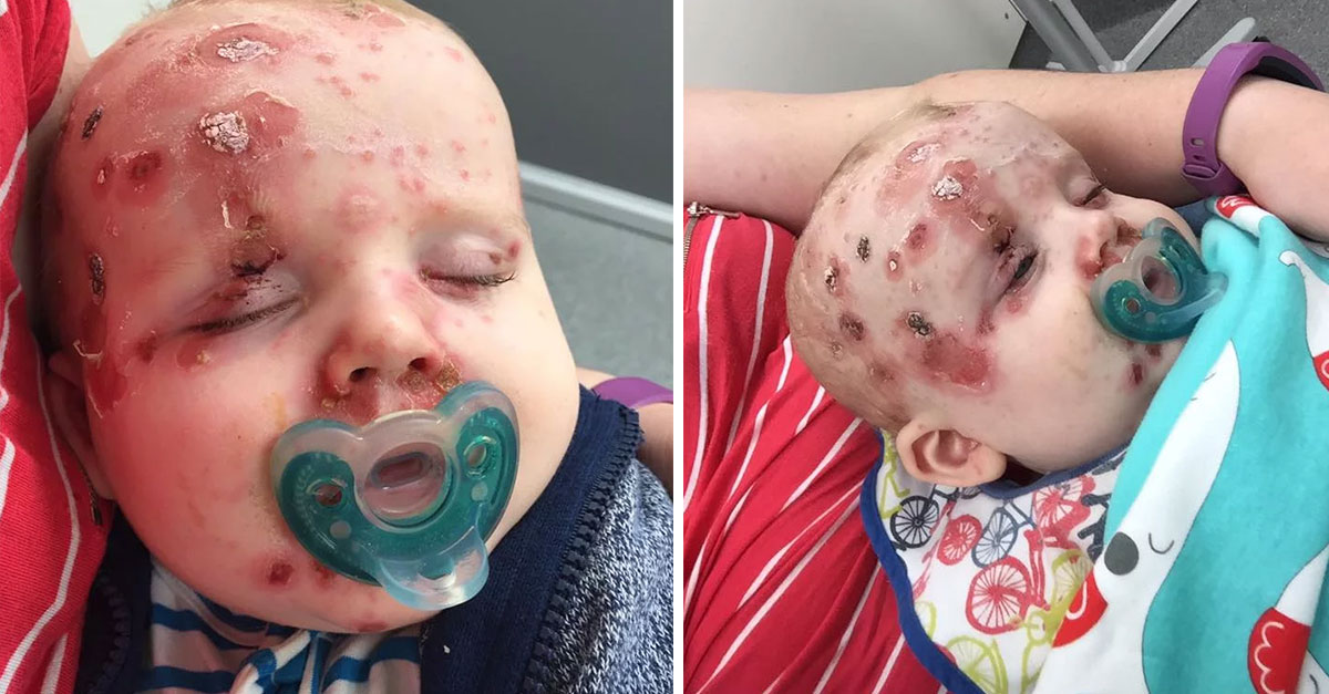 Mother Shares Frightening Photos Of Child Ridden With 