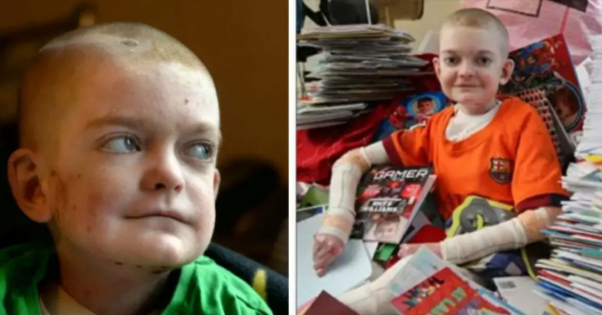 Boy With Terrible Disease Refuses To Give Up On Life