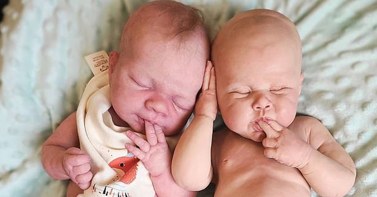 Take A Look At These Babies. Can You See What’s “Wrong” With Them?