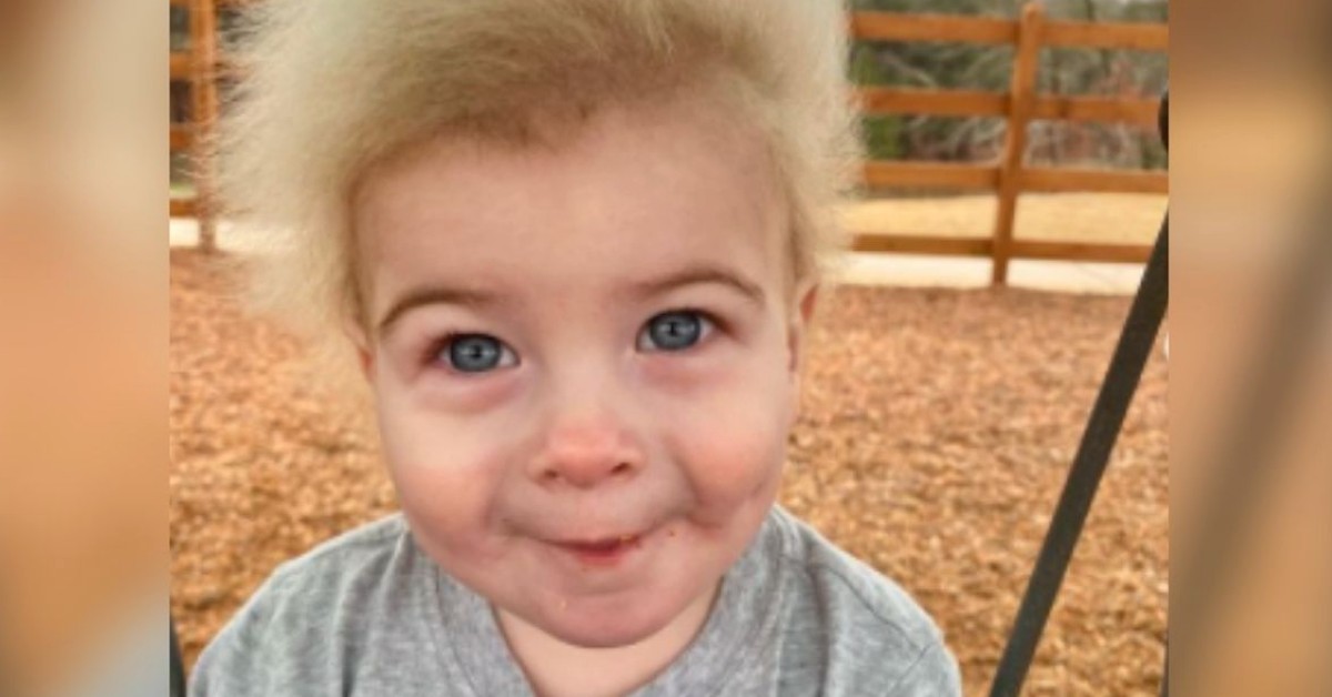 Baby Diagnosed With “Uncombable Hair” After Losing His Dark Strands And Grows A Light Peach Fuzz Instead