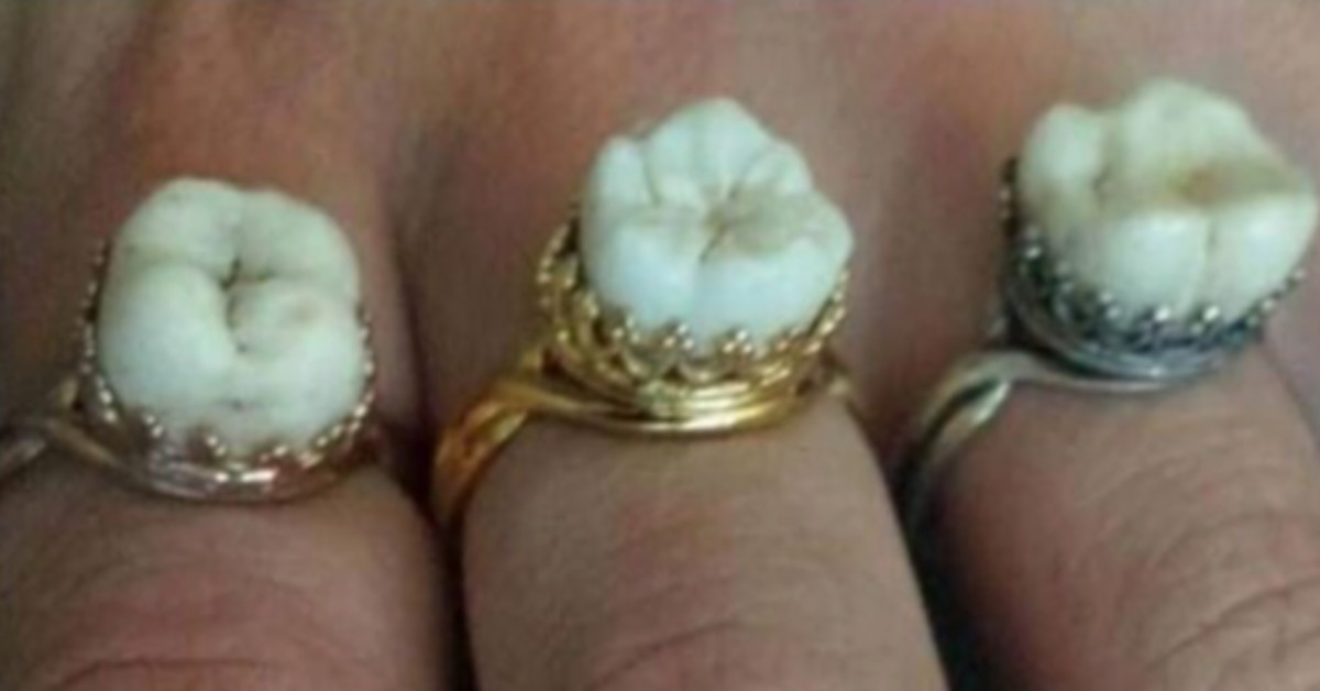 Teeth jewelry: A new way to remember loved ones